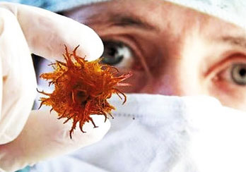 菌物营养干预菌物疗法加入抗癌新浪潮